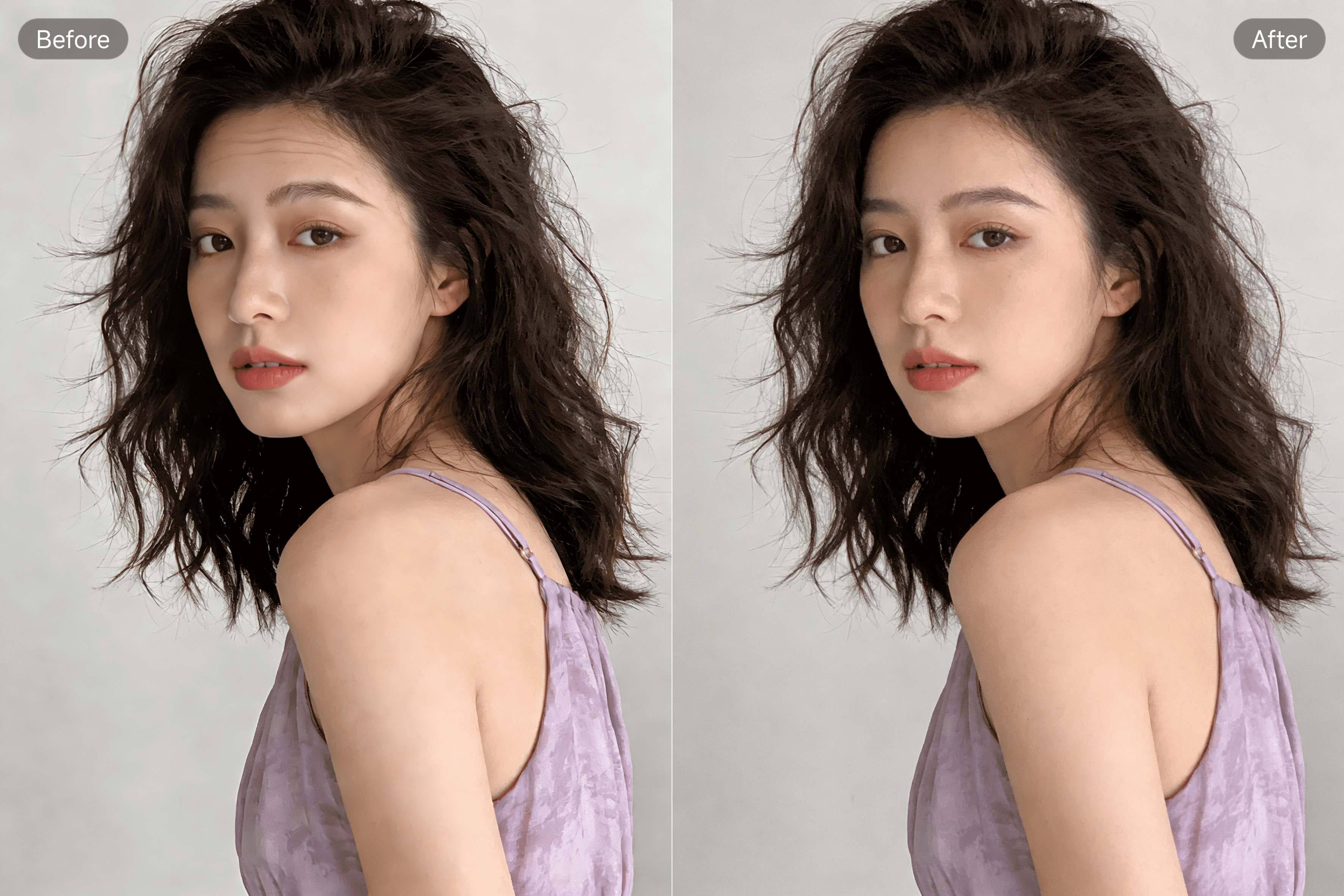 PixPretty Remove Forehead Wrinkles