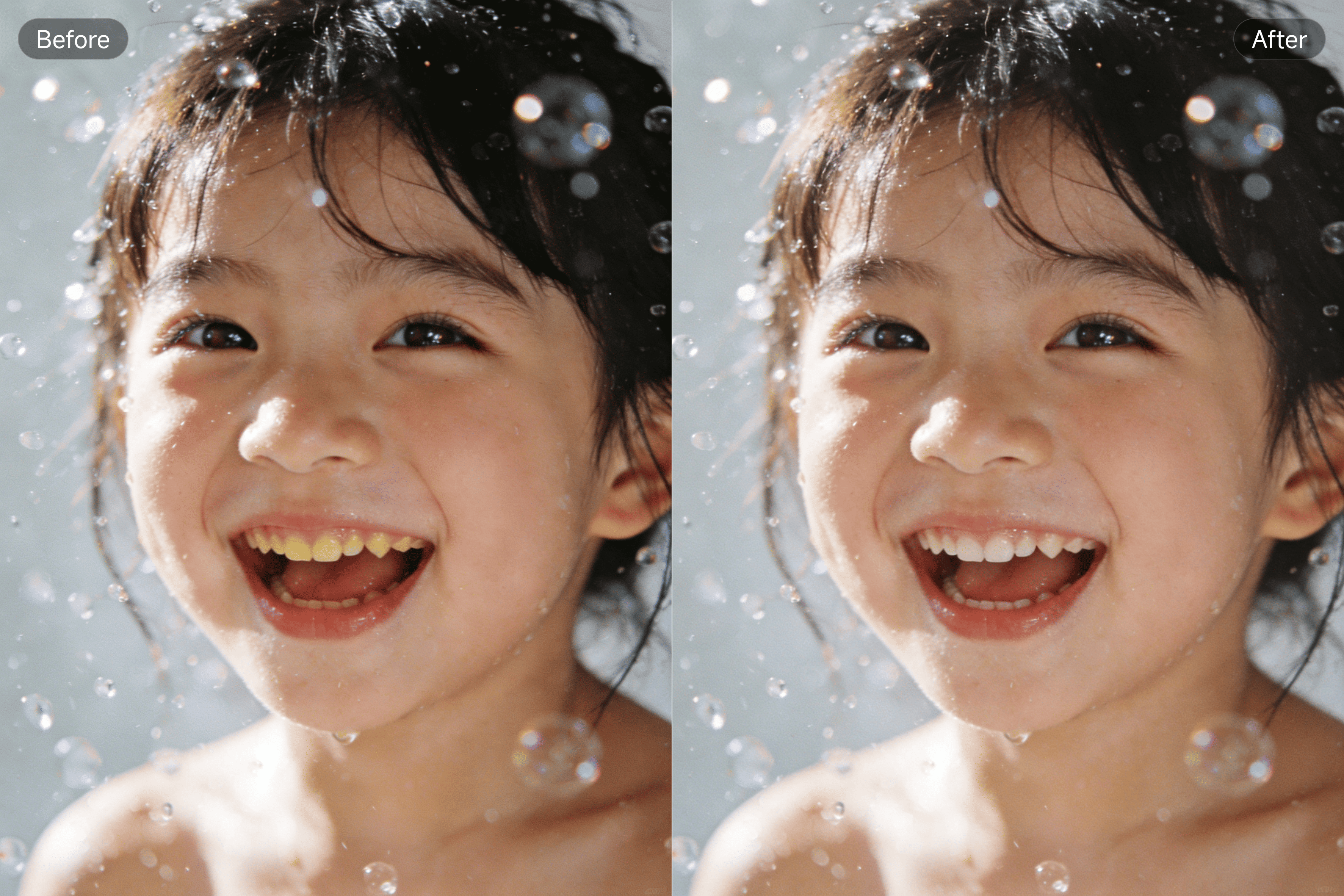 PixPretty Teeth Whitening