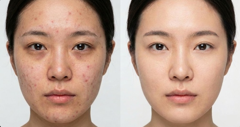 인물 사진 보정